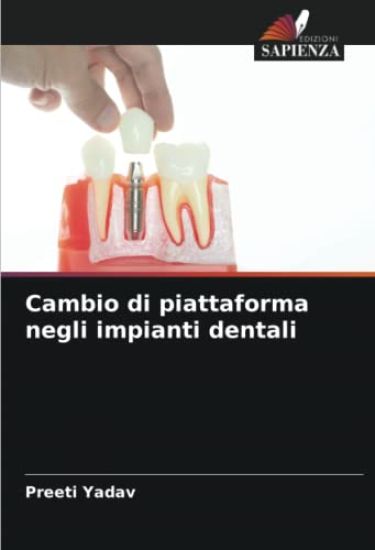 Cambio di piattaforma negli impianti dentali