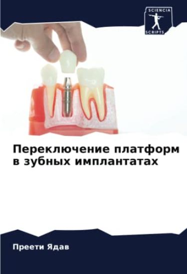 Pereklüchenie platform w zubnyh implantatah