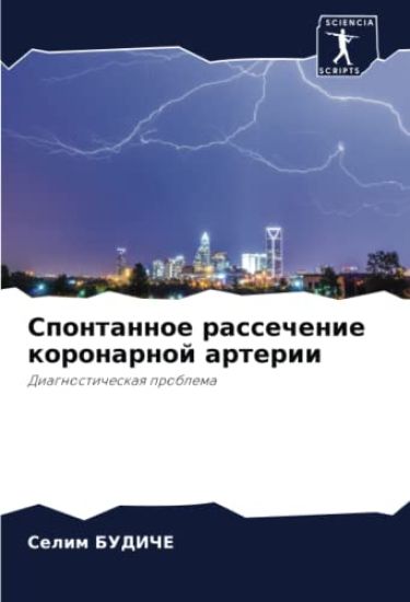 Spontannoe rassechenie koronarnoj arterii