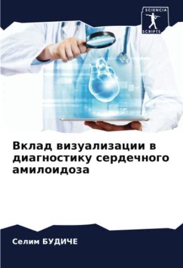 Vklad wizualizacii w diagnostiku serdechnogo amiloidoza