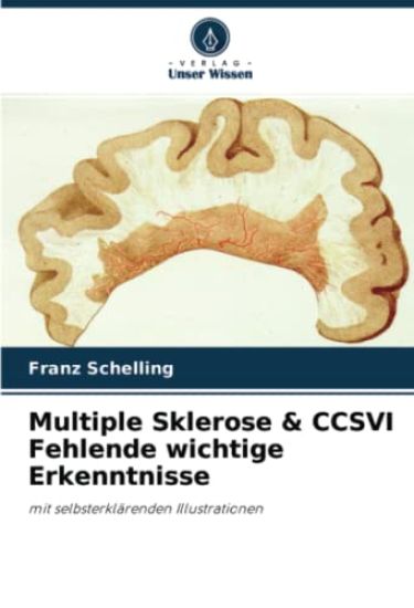Multiple Sklerose & CCSVI Fehlende wichtige Erkenntnisse