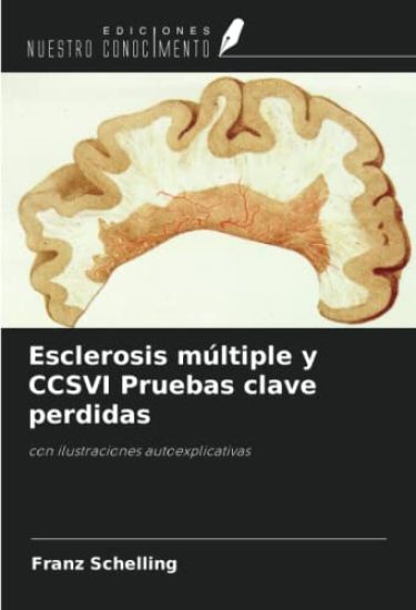 Esclerosis múltiple y CCSVI Pruebas clave perdidas
