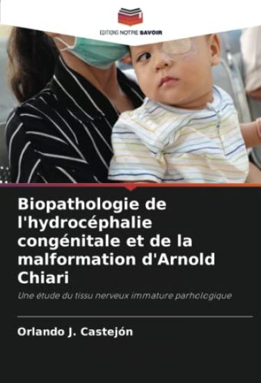 Biopathologie de l'hydrocéphalie congénitale et de la malformation d'Arnold Chiari