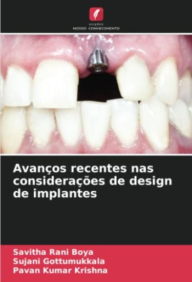 Avanços recentes nas considerações de design de implantes