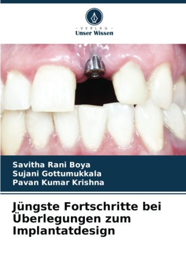 Jüngste Fortschritte bei Überlegungen zum Implantatdesign
