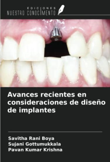 Avances recientes en consideraciones de diseño de implantes