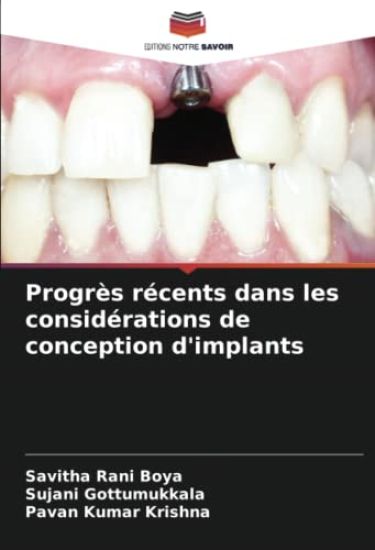 Progrès récents dans les considérations de conception d'implants
