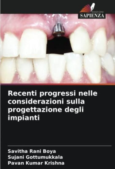Recenti progressi nelle considerazioni sulla progettazione degli impianti