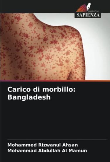 Carico di morbillo: Bangladesh