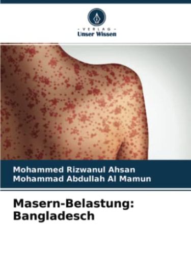 Masern-Belastung: Bangladesch