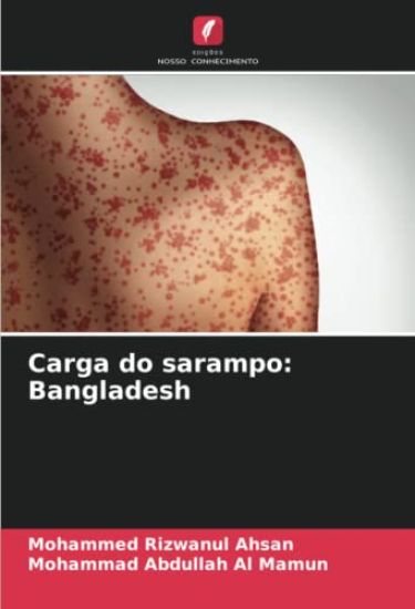 Carga do sarampo: Bangladesh