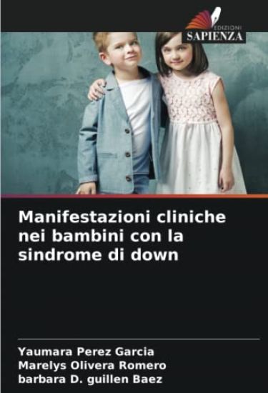 Manifestazioni cliniche nei bambini con la sindrome di down