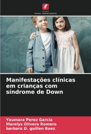 Manifestações clínicas em crianças com síndrome de Down