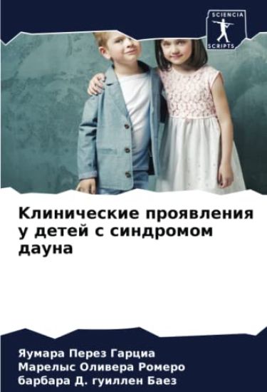 Klinicheskie proqwleniq u detej s sindromom dauna
