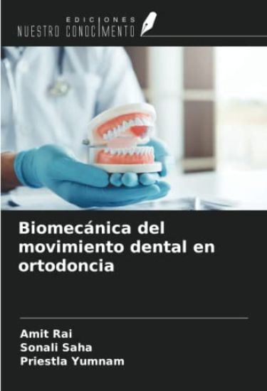 Biomecánica del movimiento dental en ortodoncia