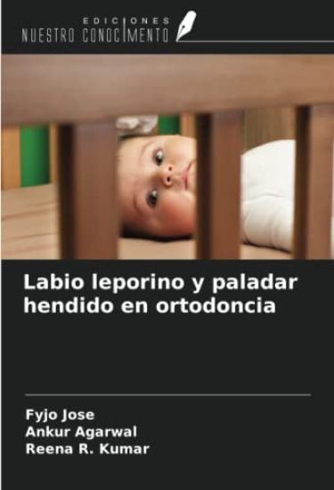 Labio leporino y paladar hendido en ortodoncia