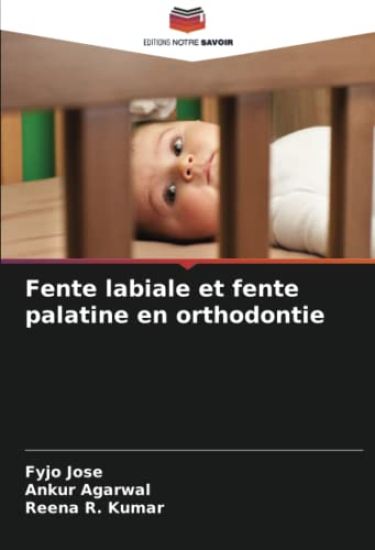 Fente labiale et fente palatine en orthodontie