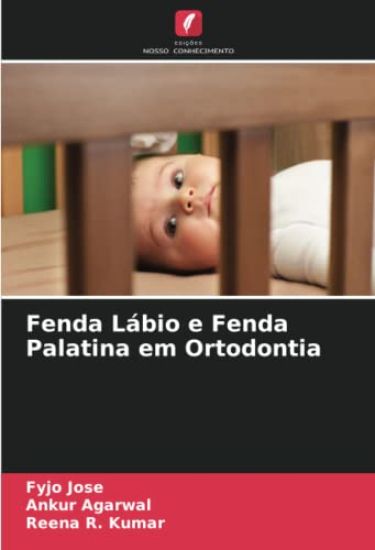 Fenda Lábio e Fenda Palatina em Ortodontia