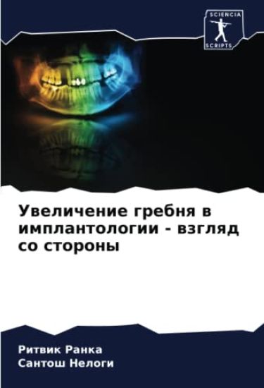 Uwelichenie grebnq w implantologii - wzglqd so storony