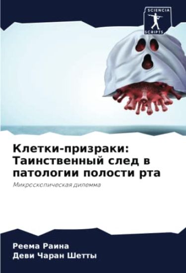 Kletki-prizraki: Tainstwennyj sled w patologii polosti rta