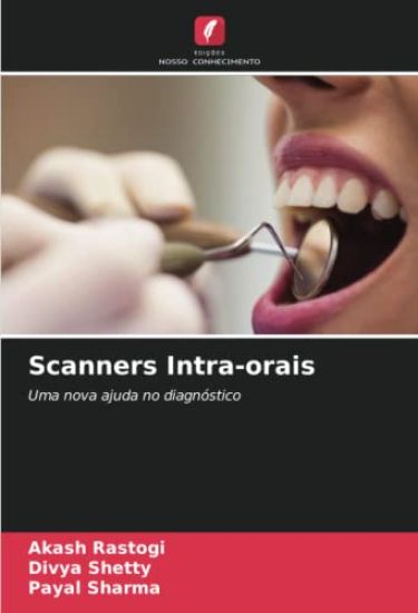 Scanners Intra-orais