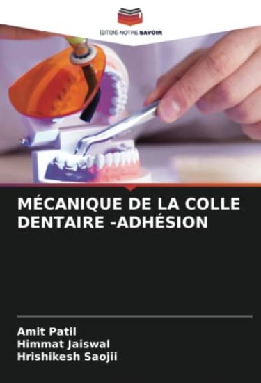 Mécanique de la Colle Dentaire -Adhésion