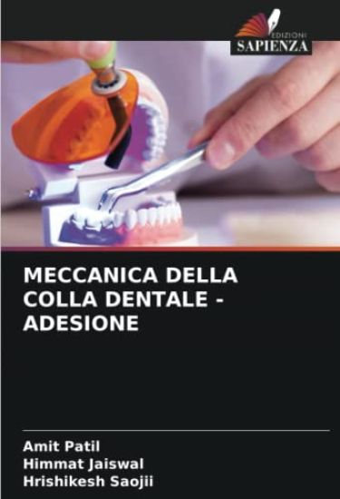 Meccanica Della Colla Dentale - Adesione