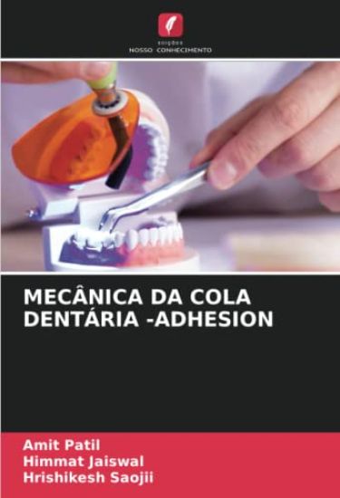 Mecânica Da Cola Dentária -Adhesion