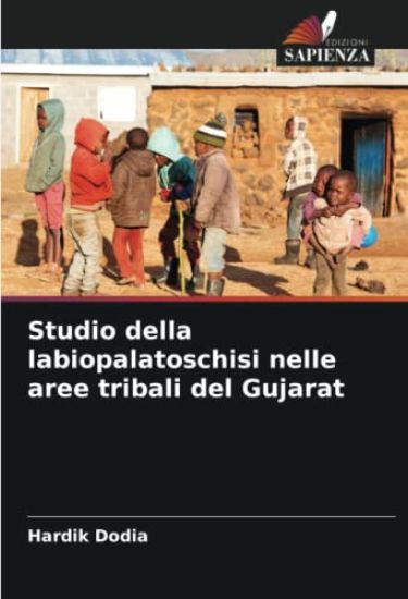 Studio della labiopalatoschisi nelle aree tribali del Gujarat