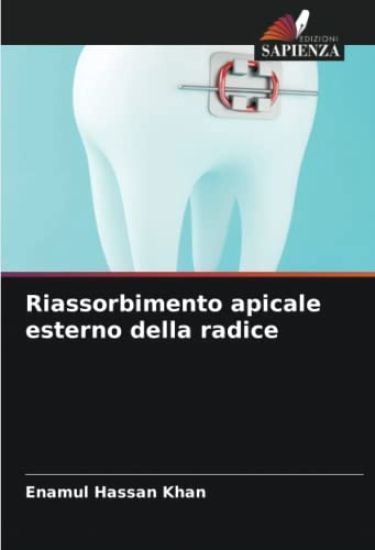 Riassorbimento apicale esterno della radice