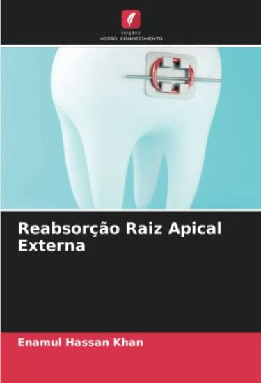 Reabsorção Raiz Apical Externa