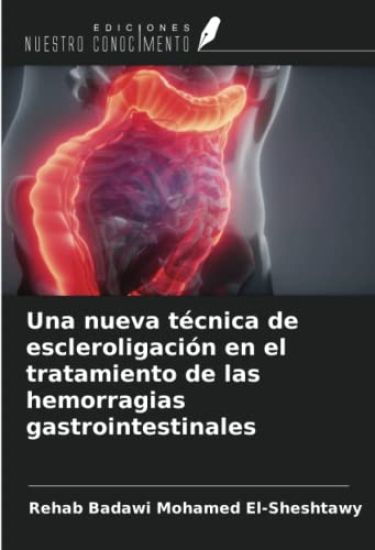 Una nueva técnica de escleroligación en el tratamiento de las hemorragias gastrointestinales