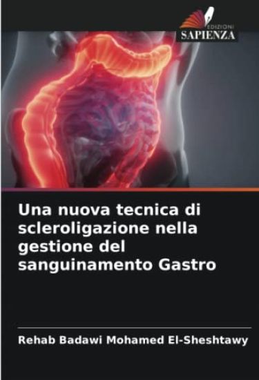Una nuova tecnica di scleroligazione nella gestione del sanguinamento Gastro