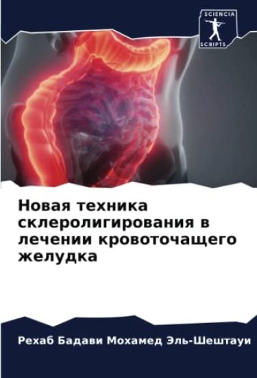 Nowaq tehnika skleroligirowaniq w lechenii krowotochaschego zheludka