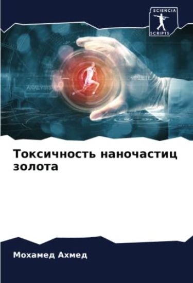 Toxichnost' nanochastic zolota