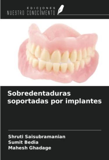Sobredentaduras soportadas por implantes