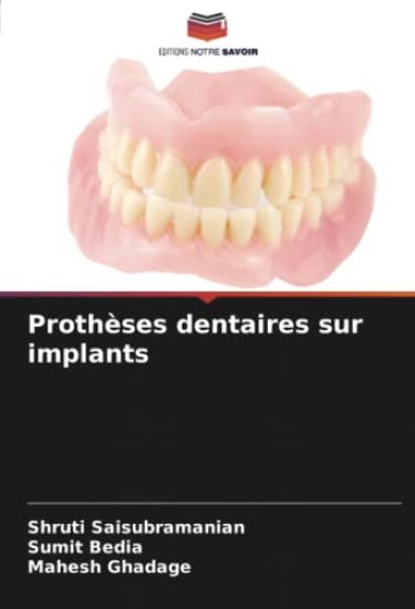 Prothèses dentaires sur implants