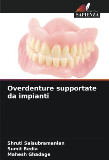 Overdenture supportate da impianti