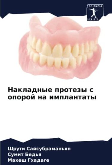 Nakladnye protezy s oporoj na implantaty