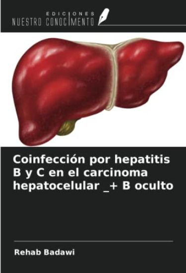 Coinfección por hepatitis B y C en el carcinoma hepatocelular _+ B oculto