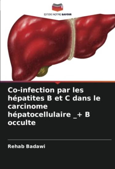 Co-infection par les hépatites B et C dans le carcinome hépatocellulaire _+ B occulte
