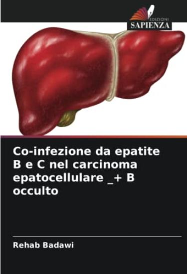 Co-infezione da epatite B e C nel carcinoma epatocellulare _+ B occulto