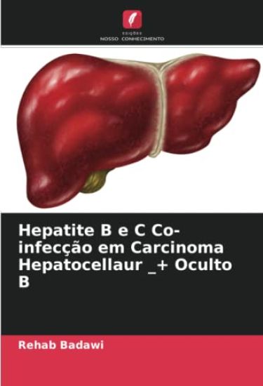 Hepatite B e C Co-infecção em Carcinoma Hepatocellaur _+ Oculto B