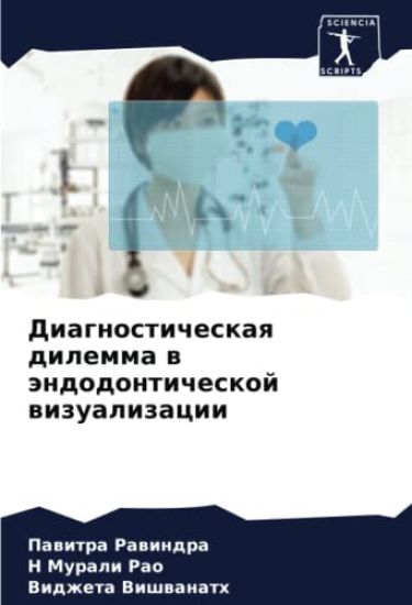 Diagnosticheskaq dilemma w ändodonticheskoj wizualizacii