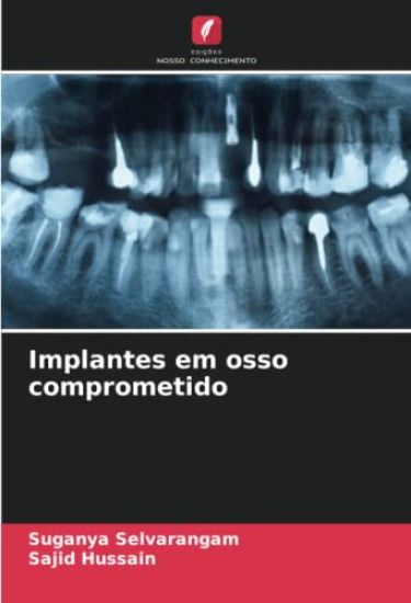 Implantes em osso comprometido