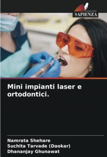 Mini impianti laser e ortodontici.