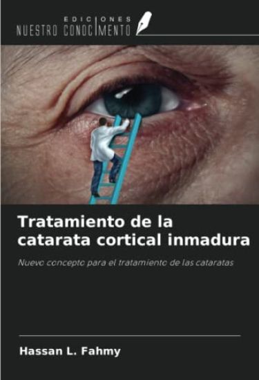 Tratamiento de la catarata cortical inmadura