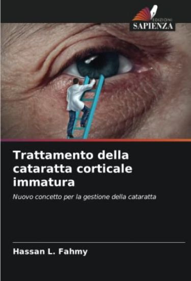 Trattamento della cataratta corticale immatura