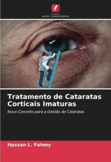 Tratamento de Cataratas Corticais Imaturas