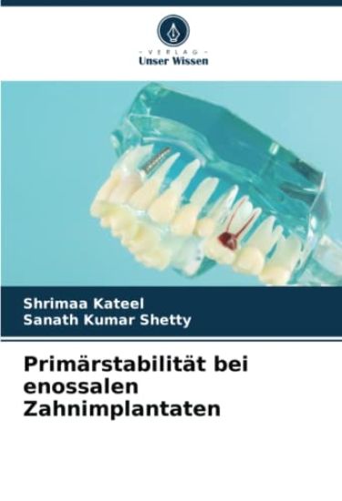 Primärstabilität bei enossalen Zahnimplantaten